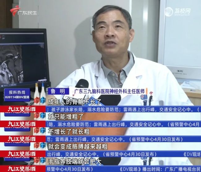 男子突然变丑 下唇比上唇厚一倍 竟是垂体瘤作祟