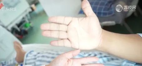 男子突然变丑 下唇比上唇厚一倍